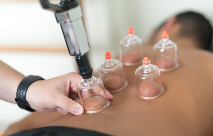 cupping massage at ABD Naturals in ST.Albert Edmonton